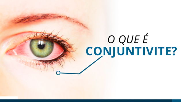 https://www.fabriciowitzel.com.br/wp-content/uploads/2019/05/img-blog-ocular-max-care-4-628x353.png